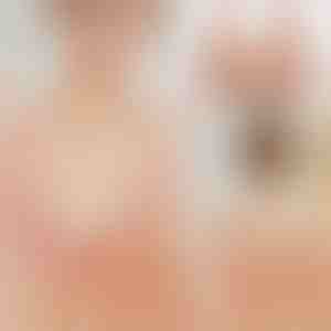 Čipkasti Grudnjak s Prednjim Zatvaranjem | FRONTBRA