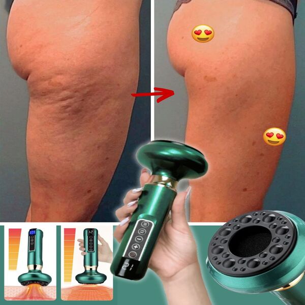 CUPESSENCE12423__280525