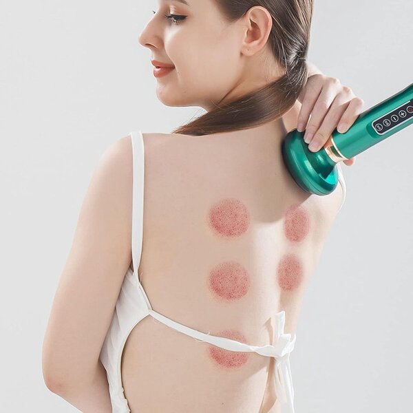 CUPESSENCE19423__280525